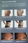Emerald Medical Aesthetics Winback Treatments